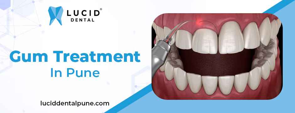 Gum Treatment In Pune