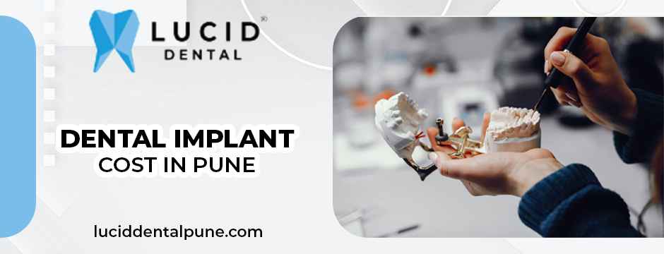 dental implant cost in Pune