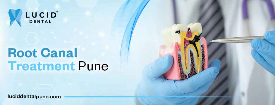 Root Canal Treatment Pune