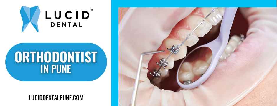 orthodontist in Pune