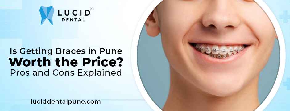Braces in Pune