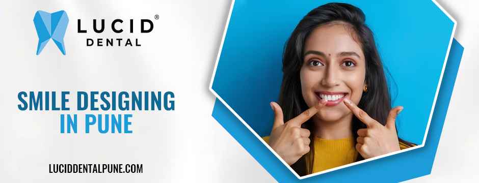 Smile Designing in Pune