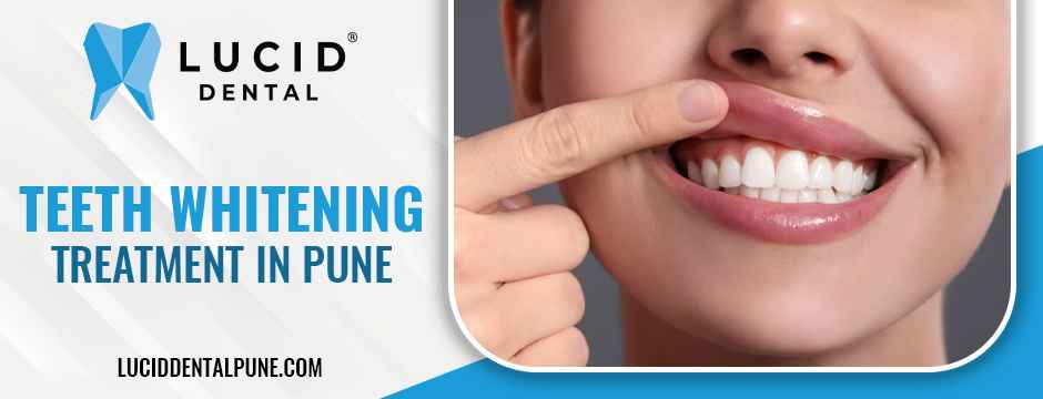 teeth whitening treatment in Pune