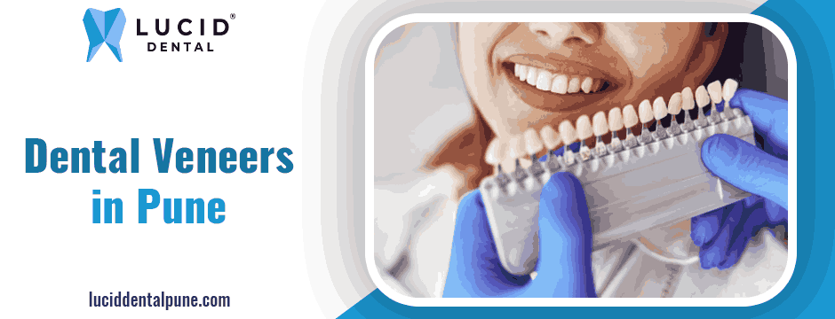 dental veneers in Pune