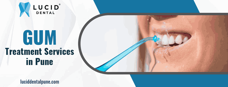 gum treatment services in Pune