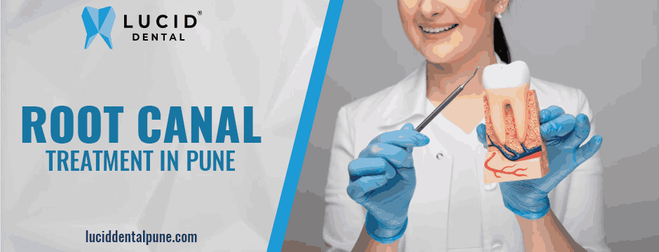 root canal treatment in Pune