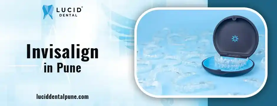 Invisalign in Pune