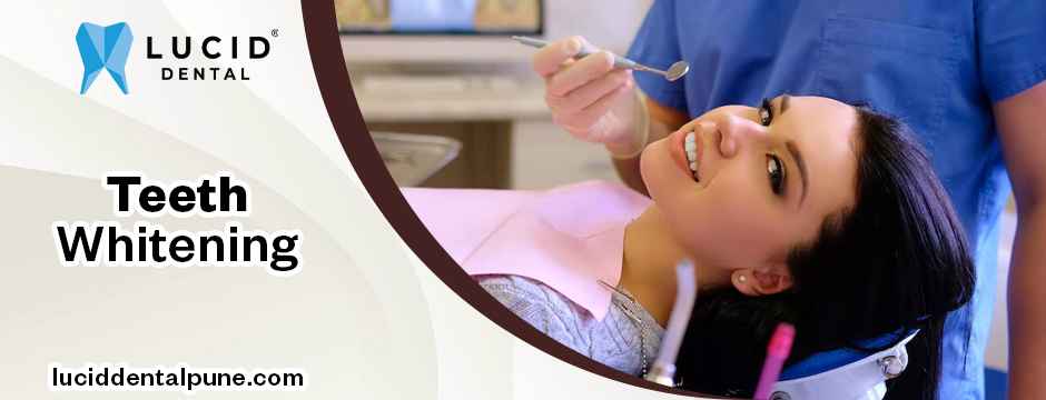teeth whitening