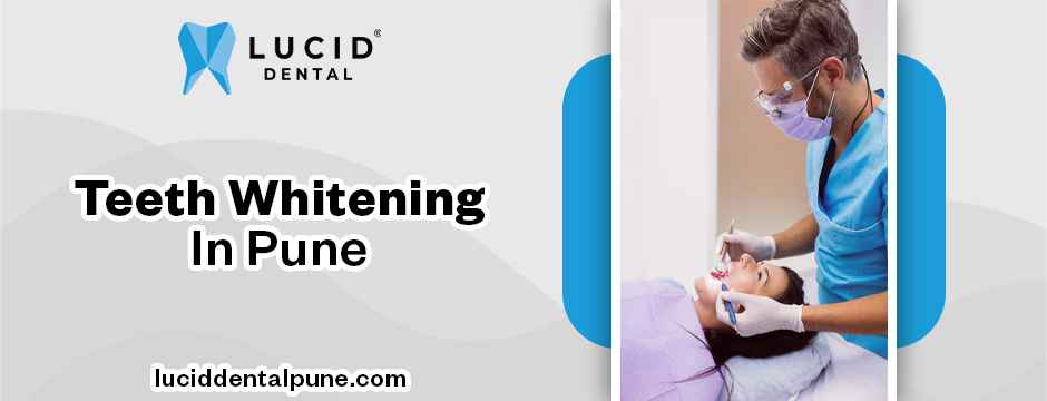 teeth whitening treatment in Pune
