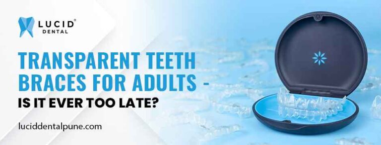 Transparent Teeth Braces