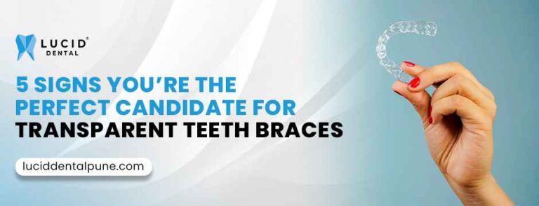 Transparent Teeth Braces