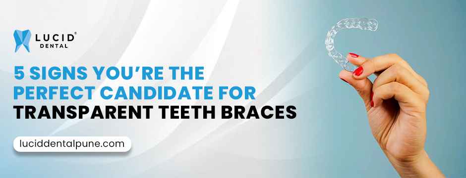 Transparent Teeth Braces