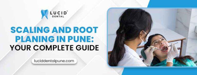 Root Planing in Pune