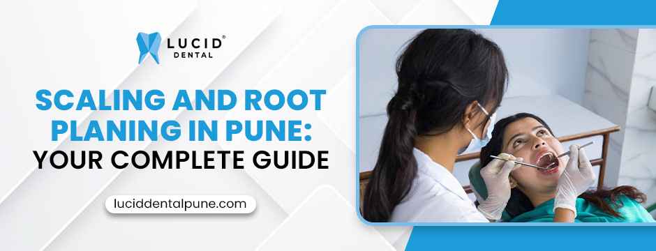 Root Planing in Pune