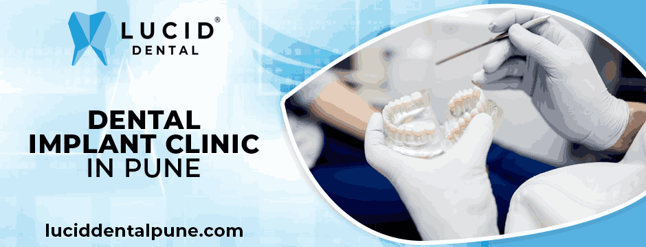 dental implant clinic in Pune