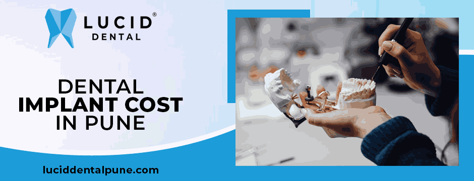 dental implant cost in Pune