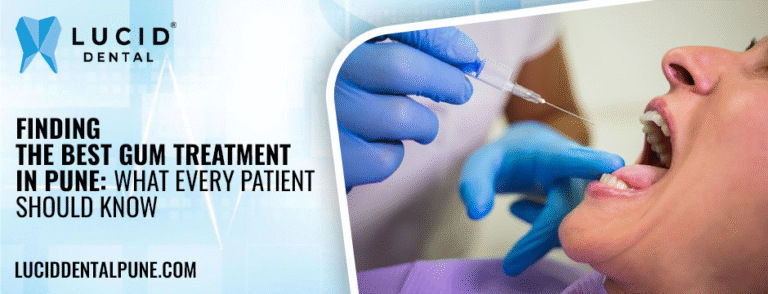 Finding the Best Gum Treatment in Pune