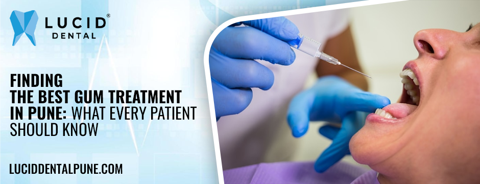 Finding the Best Gum Treatment in Pune