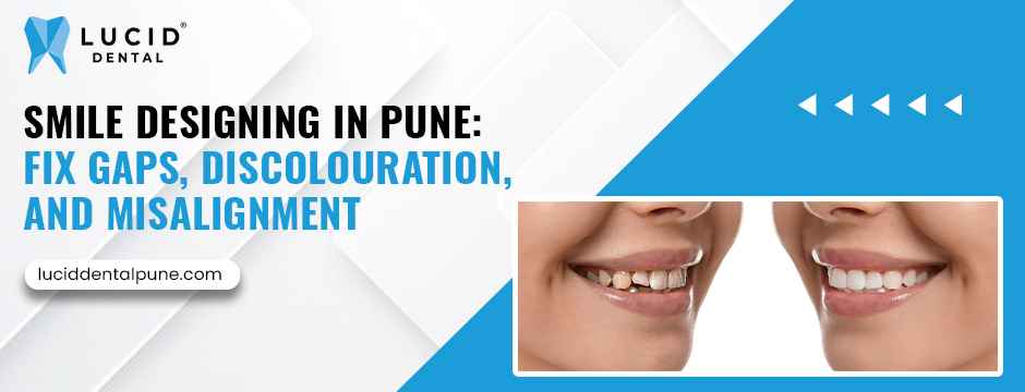 Smile Designing in Pune