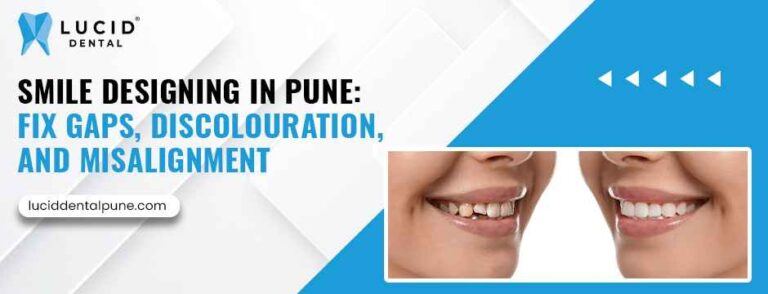 Smile Designing in Pune- Gaps, Discolouration, and Misalignment