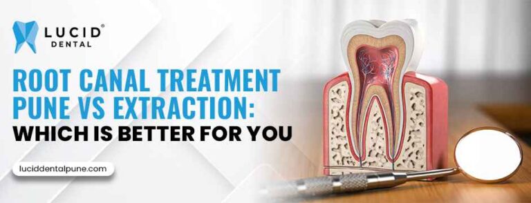 Root Canal Treatment Pune vs Extraction