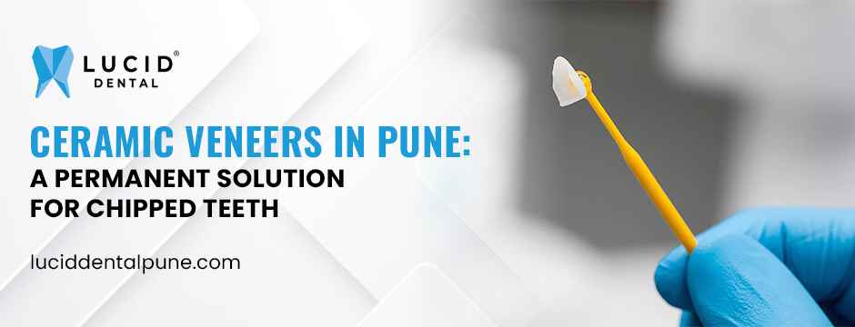 Ceramic Veneers in Pune- Perfect Solution for for Chipped Teeth