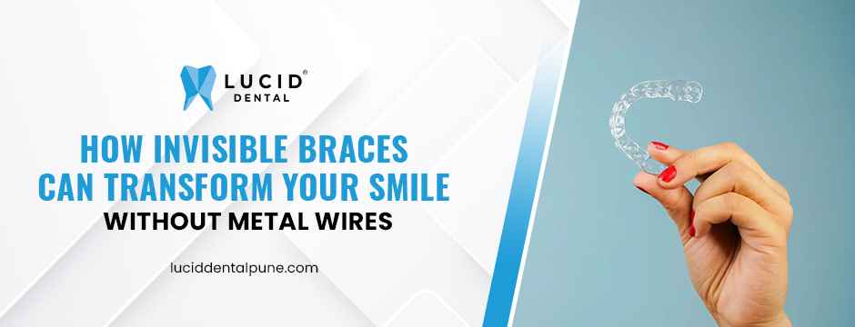 How Invisible Braces Can Transform Your Smile Without Metal Wires