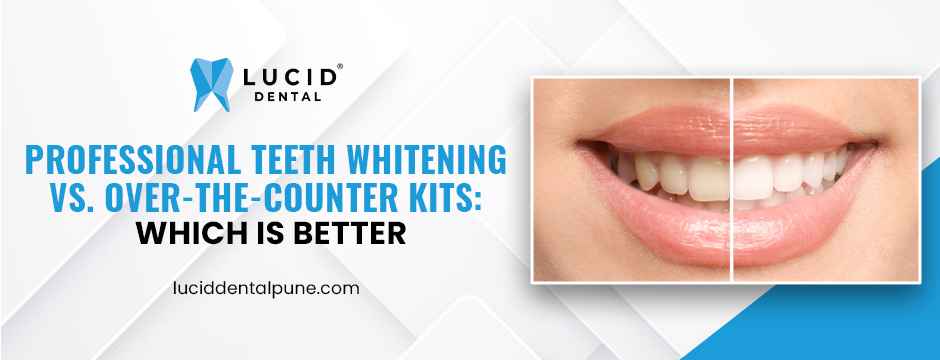 Professional Teeth Whitening vs. Over-the-Counter Kits: Which is Better