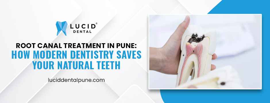 Root Canal Treatment in Pune: How Modern Dentistry Saves Your Natural Teeth