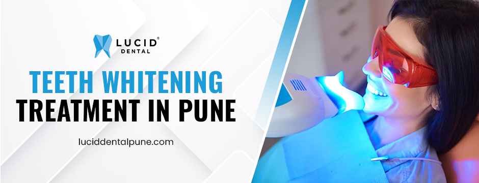 Teeth whitening treatment in Pune