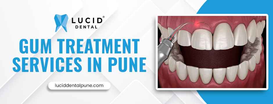 gum treatment services in Pune