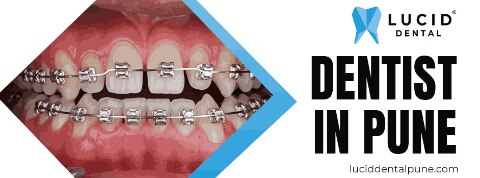 dentist in pune