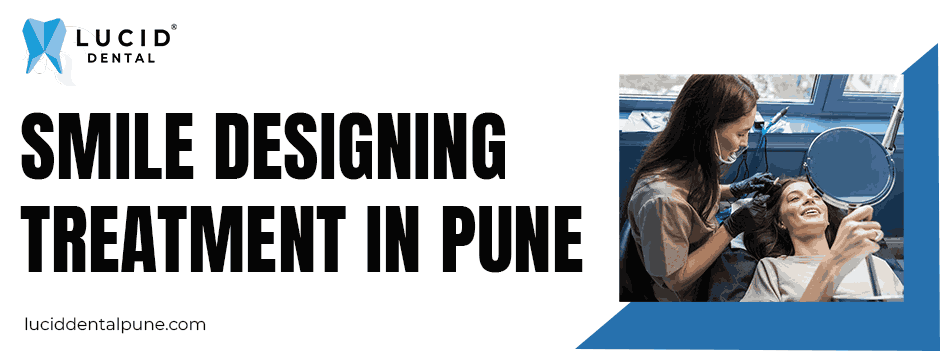 smile designing treatment in Pune