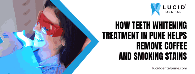 How Teeth Whitening Treatment in Pune Helps Remove Coffee and Smoking Stains
