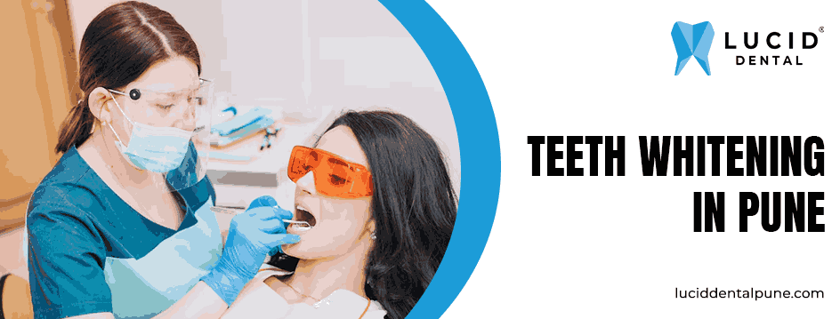 Teeth Whitening in Pune