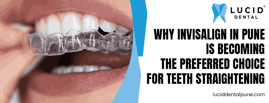 Why Invisalign in Pune Is Becoming the Preferred Choice for Teeth Straightening