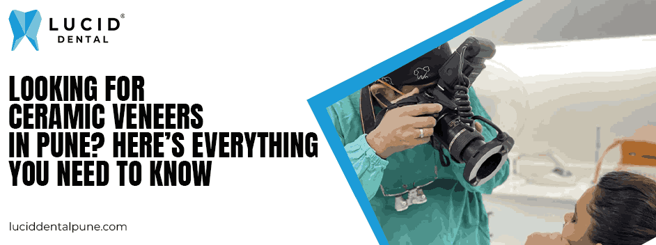 Looking for Ceramic Veneers in Pune? Here’s Everything You Need to Know