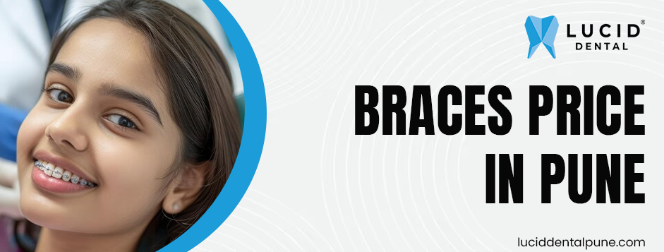 Braces price in Pune