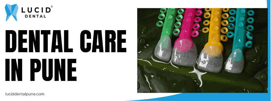 Dental Veneers in Pune