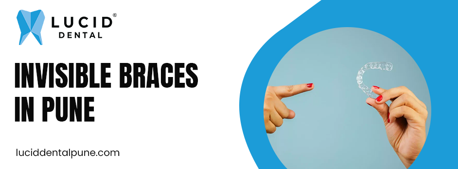 invisible braces in Pune