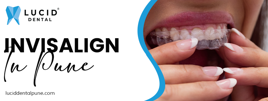 Invisalign in Pune