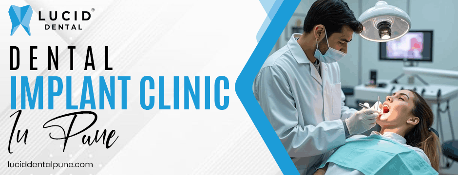 Dental Implant Clinic in Pune