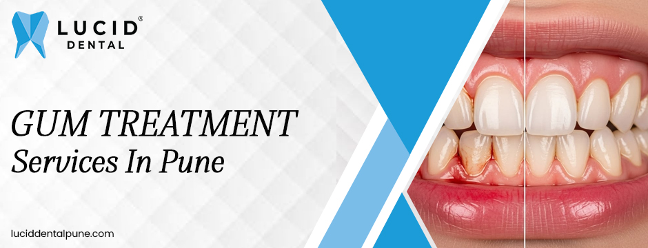 Gum Treatment Services in Pune