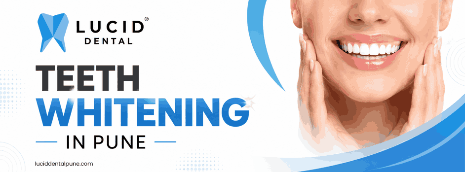 Teeth Whitening In Pune