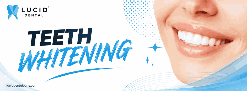 teeth whitening