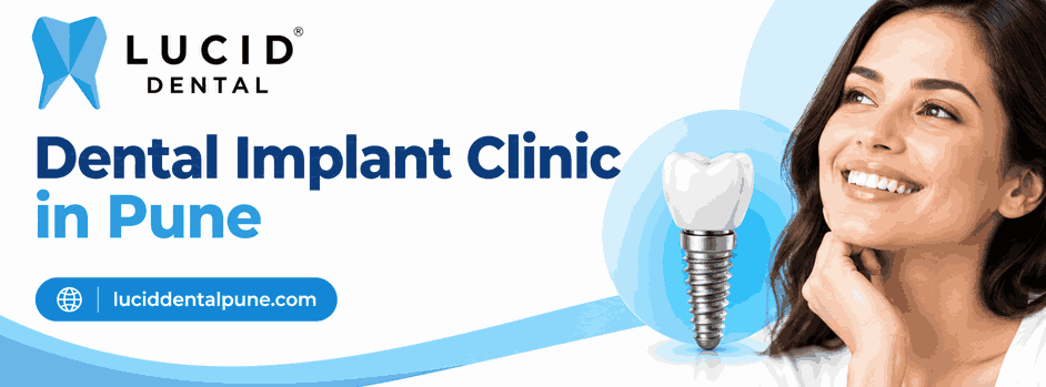 Dental Implant Clinic in Pune