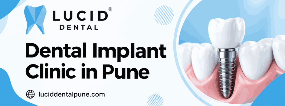 Dental Implant Clinic in Pune