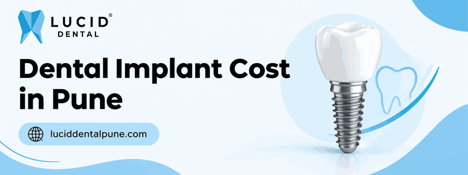 Dental implant cost in Pune