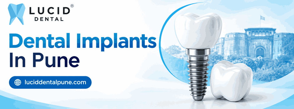 Dental implants in Pune