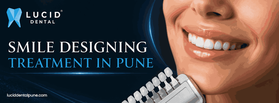 Smile designing treatment in Pune